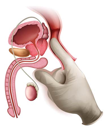 prostat anatomi-mutlucihangiroglu.com.jpg