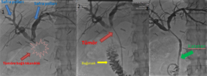 From diagnosis to treatment in cancer