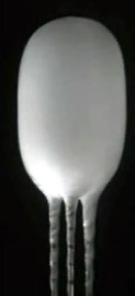 B&ouml;brek Ablasyonu