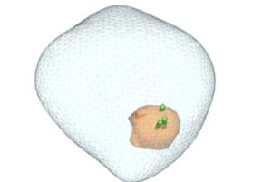 prostat biyopsisi