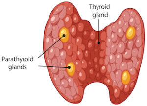 Paratiroid Adeonom Tedavisi
