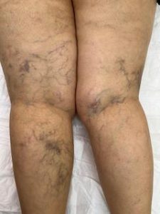 Varis ile İlgili Sık Sorulan Sorular